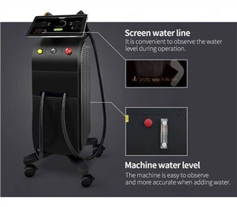 El sistema de depilación láser más avanzado del mundo: Soprano Titanium