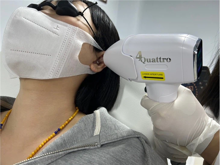 High Energy Diode Laser Hair Removal