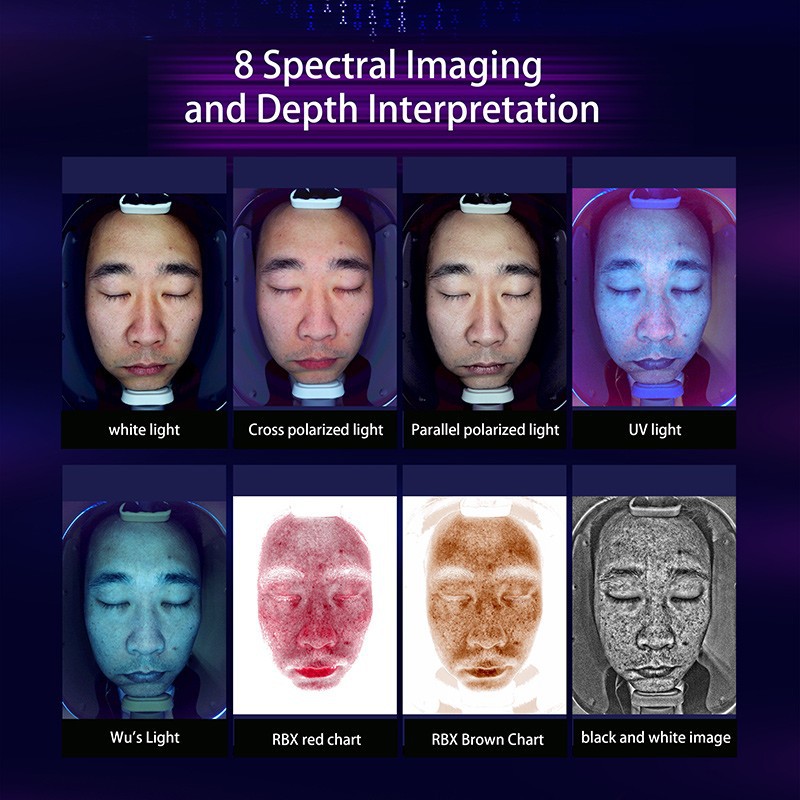 AI Skin Image Analyzer – Intelligent Skin Detection System suppliers