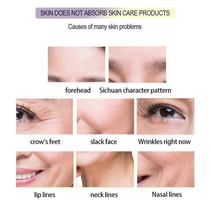 Medical Fractional CO2 Laser System