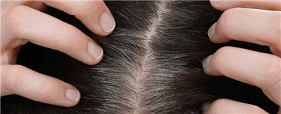¿Pueden los últimos equipos de depilación láser eliminar las canas?