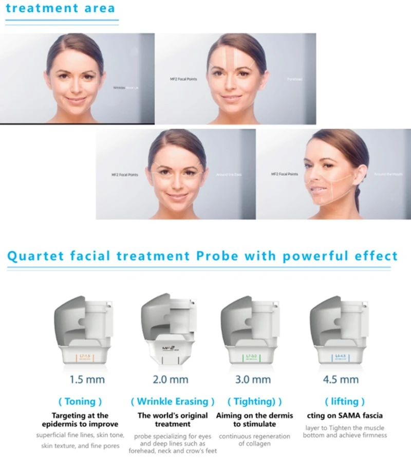 7D-Hifu-treatment 7D-Hifu-treatment