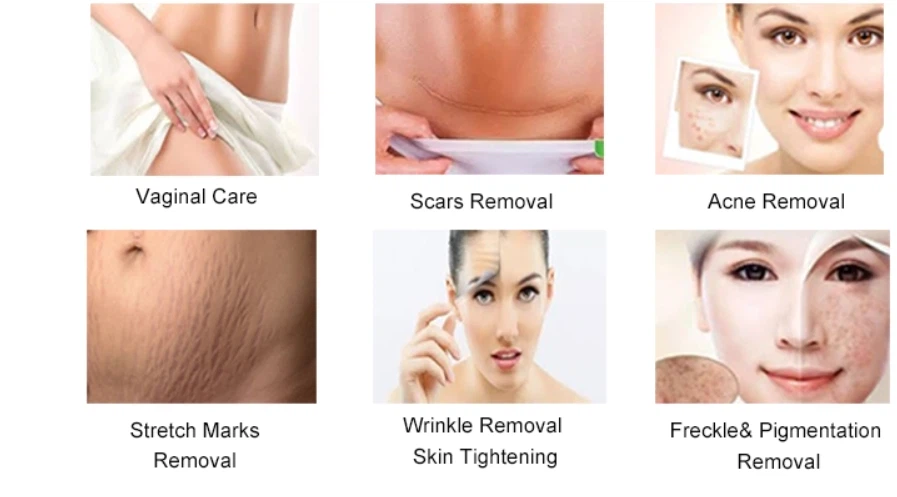 Professional CO2 Laser Machine suppliers