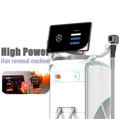 Máquina de depilación láser de venta caliente en Europa